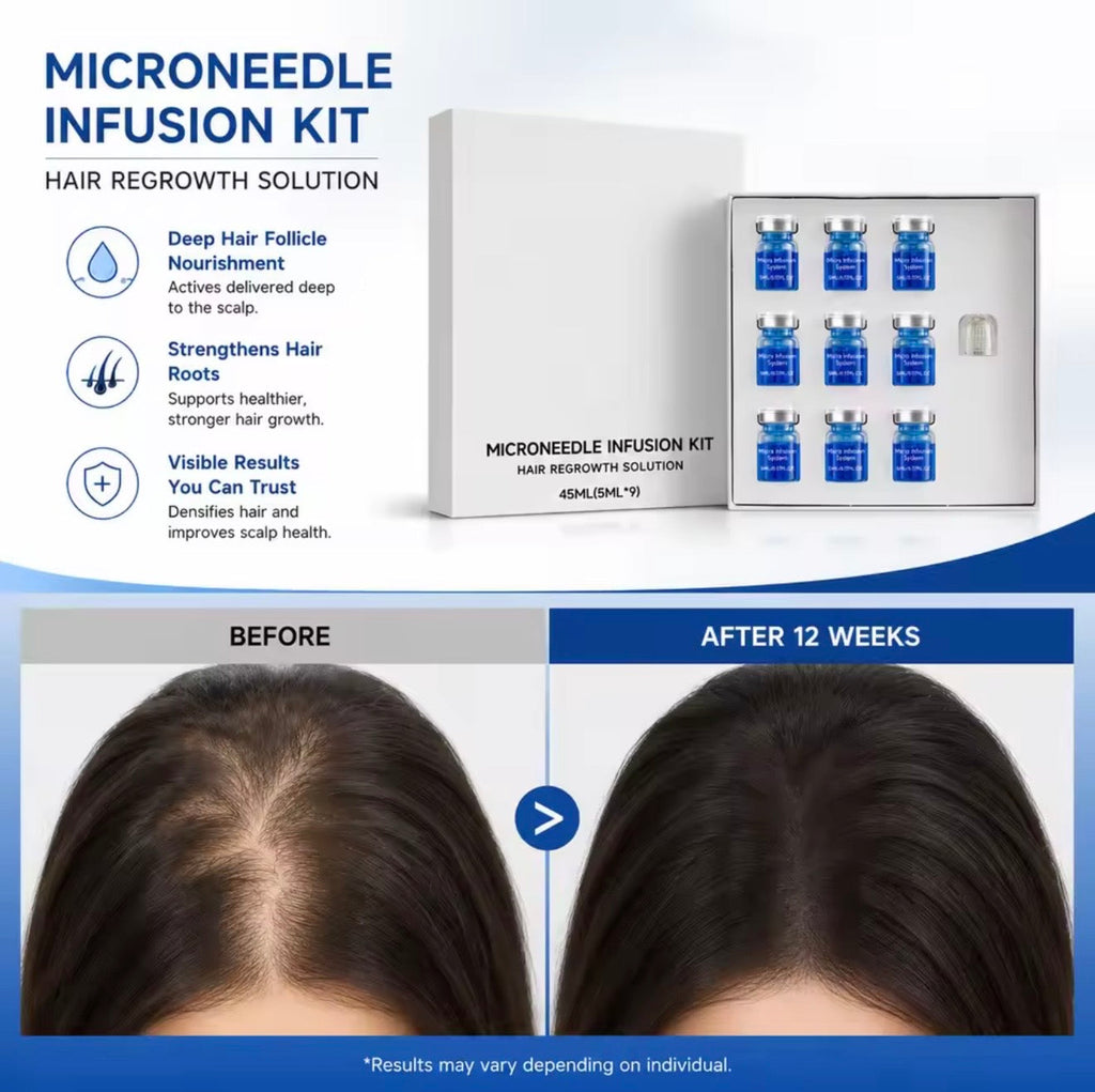 Kit Microneedle Infusion - Sérum para Crecimiento Capilar